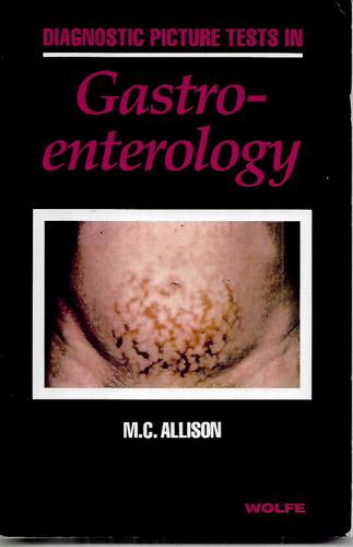 Diagnostic Picture Tests In Gastroenterology by Miles C. Allison